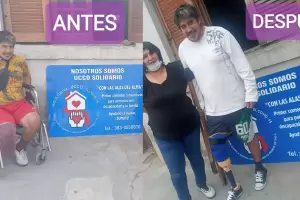 Un logro conmovedor: UCCO Solidario facilit la prtesis para la pierna de Ramn