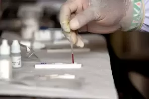 Estados Unidos investiga la muerte de cinco nios por hepatitis de origen desconocido