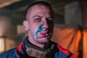 Las desgarradoras imgenes de los combatientes heridos que resisten en las ruinas de Mariupol