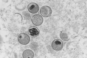 Rusia acus a bio-laboratorios de EE. UU. de causar la propagacin de la viruela del mono