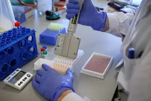 Por seguridad, la OMS suspendi los ensayos con hidroxicloroquina