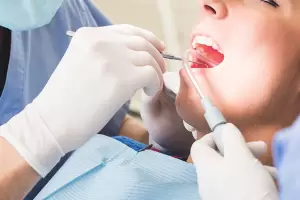 PAMI: Cmo acceder a los tratamientos odontolgicos gratuitos?