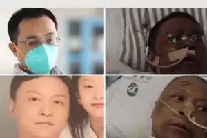 Muri� el m�dico cuya piel se puso negra a causa del coronavirus