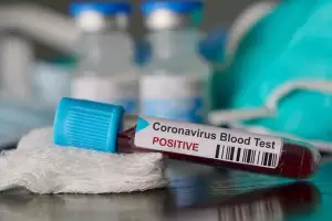 Un estudio revel� cu�nto duran los anticuerpos en quienes ya tuvieron coronavirus