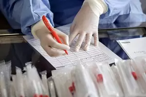 El Gobierno difundir un nico reporte diario sobre Covid-19