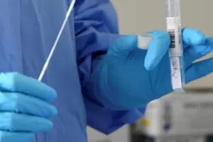 Coronavirus en Argentina: hubo 10.561 nuevos casos y 161 muertes