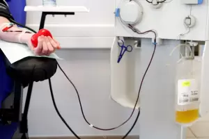 Nuevo estudio sobre plasma de convalecientes: Fernando Polack dijo que transforma a la enfermedad en un mal catarro