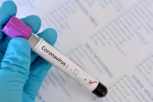 Con 37 nuevos casos de coronavirus, Catamarca lleg� a los 1.580 contagios acumulados