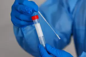 Confirmaron 30 contagios nuevos de COVID-19 en Catamarca