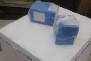 Una paciente, de 69 aos, fue la primera en recibir tratamiento con suero equino en Catamarca