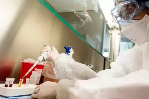 En las ltimas 24 horas se registraron 86 casos nuevos de coronavirus en Catamarca