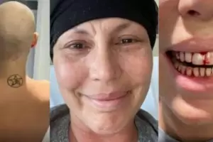 Celina Rucci cont� que tuvo leucemia: las impactantes im�genes del tratamiento