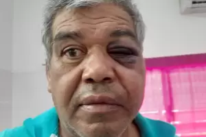 Denunci� a la Comisar�a de Chumbicha por atacar a golpes a su hermano y dejarlo en Terapia Intensiva