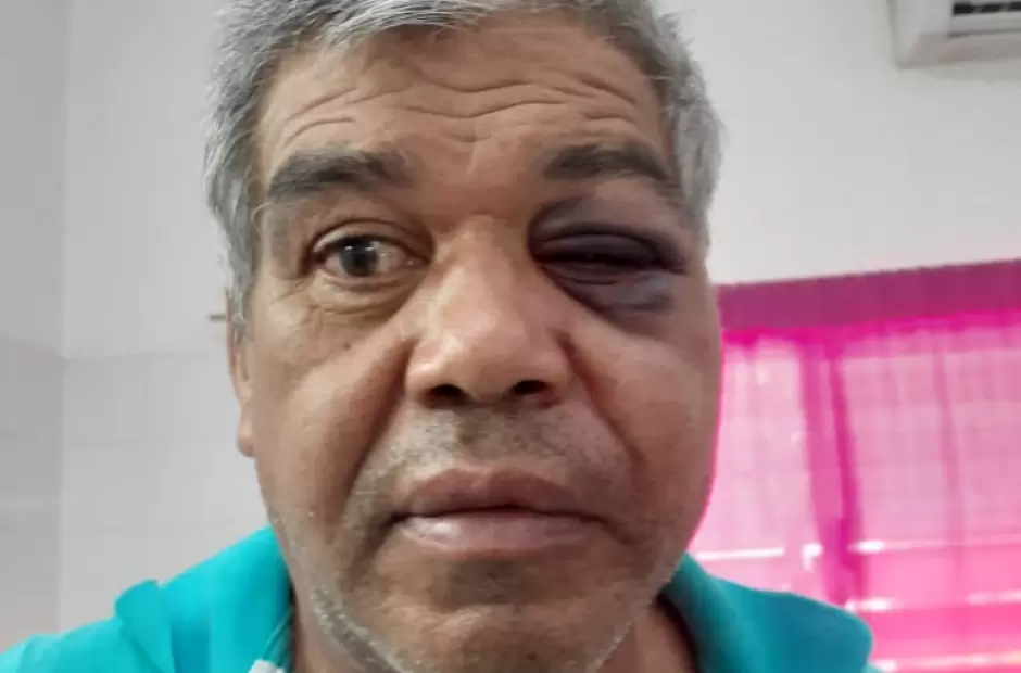 Roque Rearte sufri� severas lesiones que lo dej� internado en Terapia Intensiva.