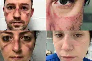 La respuesta de los m�dicos a Alberto Fern�ndez por su cr�tica al sistema sanitario: �#relajadoslaspelotas�