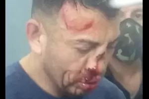 Presos golpearon y desfiguraron al femicida de Anal�a Maldonado