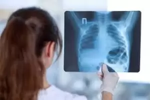 Validez nacional para la tecnicatura en Radiolog�a