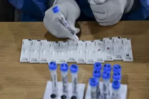 Sputnik V: comienza hoy la produccin en el pas del componente 2