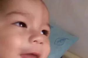 El nio que necesita el botn gstrico podra recibir maana el dispositivo