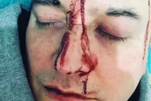 Leo Garc�a denunci� que fue v�ctima de un ataque homof�bico