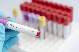 La ONU busca erradicar el SIDA como riesgo para la salud en 2030