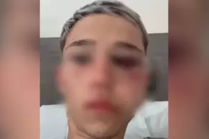 Le agarr la cabeza y le di con la rodilla: el audio que complica a uno de los rugbiers de Mendoza