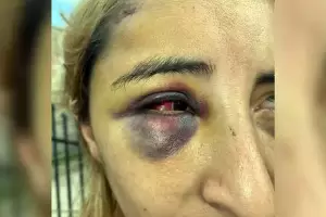 Escondi a su expareja debajo de la cama porque pens que la haba matado a golpes