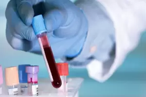 Se casaron, tuvieron dos hijos y descubrieron que son hermanos