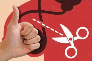 Las vasectomas se multiplicaron por 12 entre 2015 y 2019 en Argentina