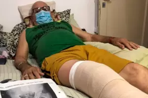 Indignante: un jubilado deb�a realizarse una cirug�a de cadera, pero le operaron la rodilla