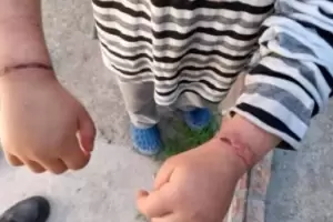 Maltrato infantil: rescataron a un nio de seis aos que era atado con alambre por su madre