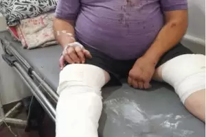 Un vendedor ambulante de 62 aos fue atropellado y lo abandonaron en la calle