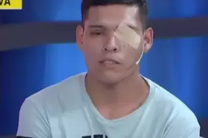 Dos policas le dispararon a dos jvenes y uno de ellos qued ciego: fueron detenidos