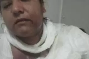 San Juan: discuta con su nuera  y le tir agua hirviendo