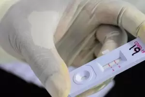 Bioqumicos advierten que los resultados de los autotest de Covid son inciertos