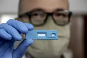 Cmo adquirir el test de autoevaluacin: todos los detalles tras la autorizacin de ANMAT