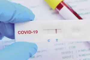 Los primeros autotest estaran disponibles la prxima semana en farmacias