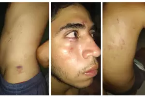 Denuncian por apremios a tres efectivos policiales del puesto caminero de Las Rejas