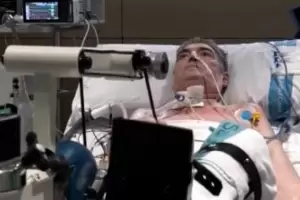 A causa del Coronavirus le tuvieron que trasplantar los pulmones: "casi se deshacan entre los dedos