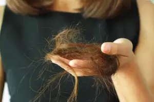 La variante micron y el "efluvio telgeno", un nuevo sntoma pos Covid