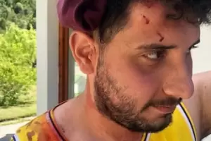 Dos jvenes denunciaron a los mapuches de El Bolsn: Les pegaron en la cabeza con palos