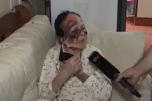 Golpearon brutalmente a una jubilada para robarle su dinero: "Tengo mucho miedo"