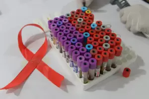 El laboratorio Moderna inici ensayos para una nueva vacuna contra el HIV, desarrollada con la misma tecnologa anticovid