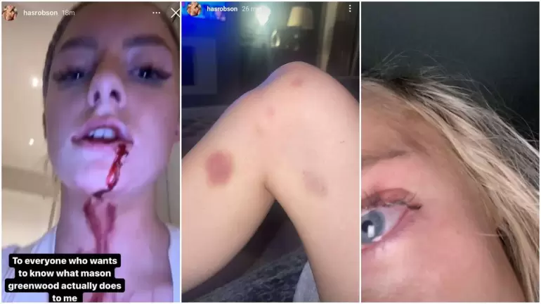 v5w7bleymvft3msoyjxfmdplgi