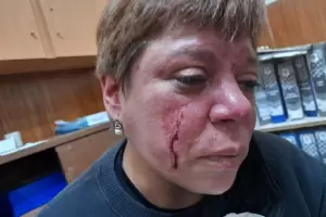 Una inspectora fue brutalmente agredida por los due�os de una hamburgueser�a que estaba clausurando