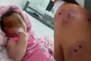 Horror: Una beb� de 5 meses y su t�a recibieron balazos de goma por parte de polic�as que persegu�an a un delincuente