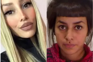 Tamara Bez se refiri a su foto de "antes de ser famosa" y revel su prxima ciruga esttica