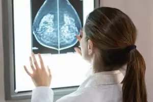 Investigadores descubrieron un modo de penetrar las clulas humanas para atacar el cncer