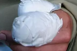 Tucumn: Cometi un robo y le amputaron dos dedos antes de que llegara la polica