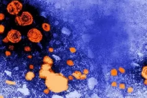 La OMS confirm 169 casos y una muerte en 11 pases por la nueva hepatitis infantil aguda